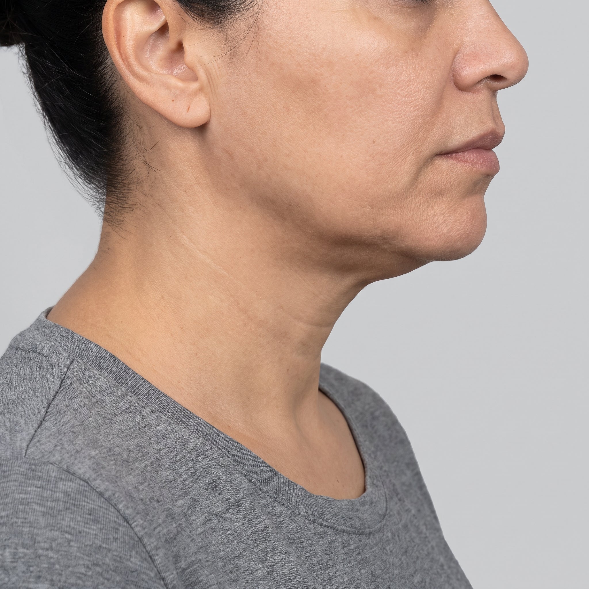 Loss of jawline definition