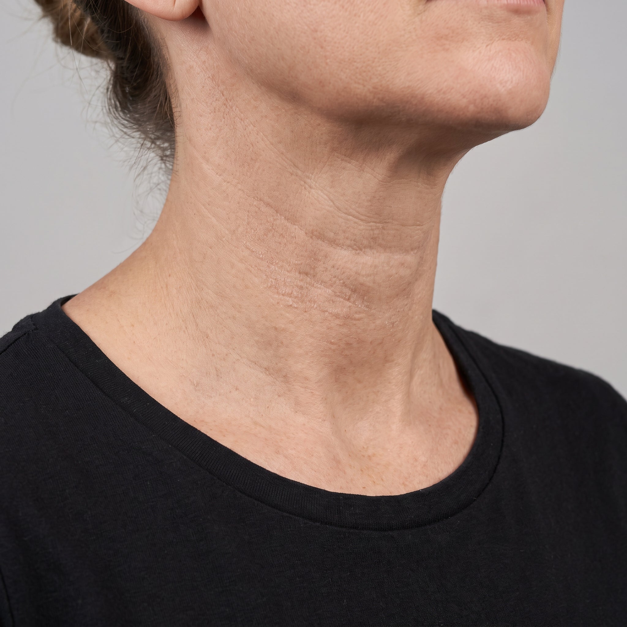Neck lines